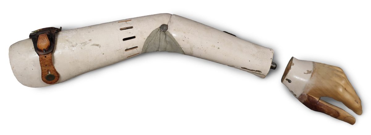 Prosthetic arm